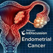 Podcast Medscape InDiscussion: Endometrial Cancer
