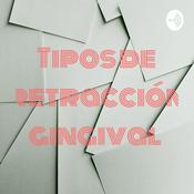 Podcast Tipos de retracción gingival
