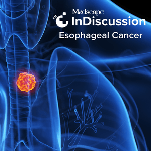 Medscape InDiscussion: Esophageal Cancer
