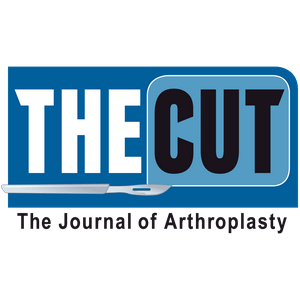 The Journal of Arthroplasty’s: The Cut